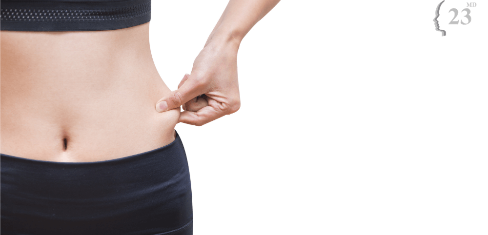 Woman pinching stubborn fat before Coolsculpting