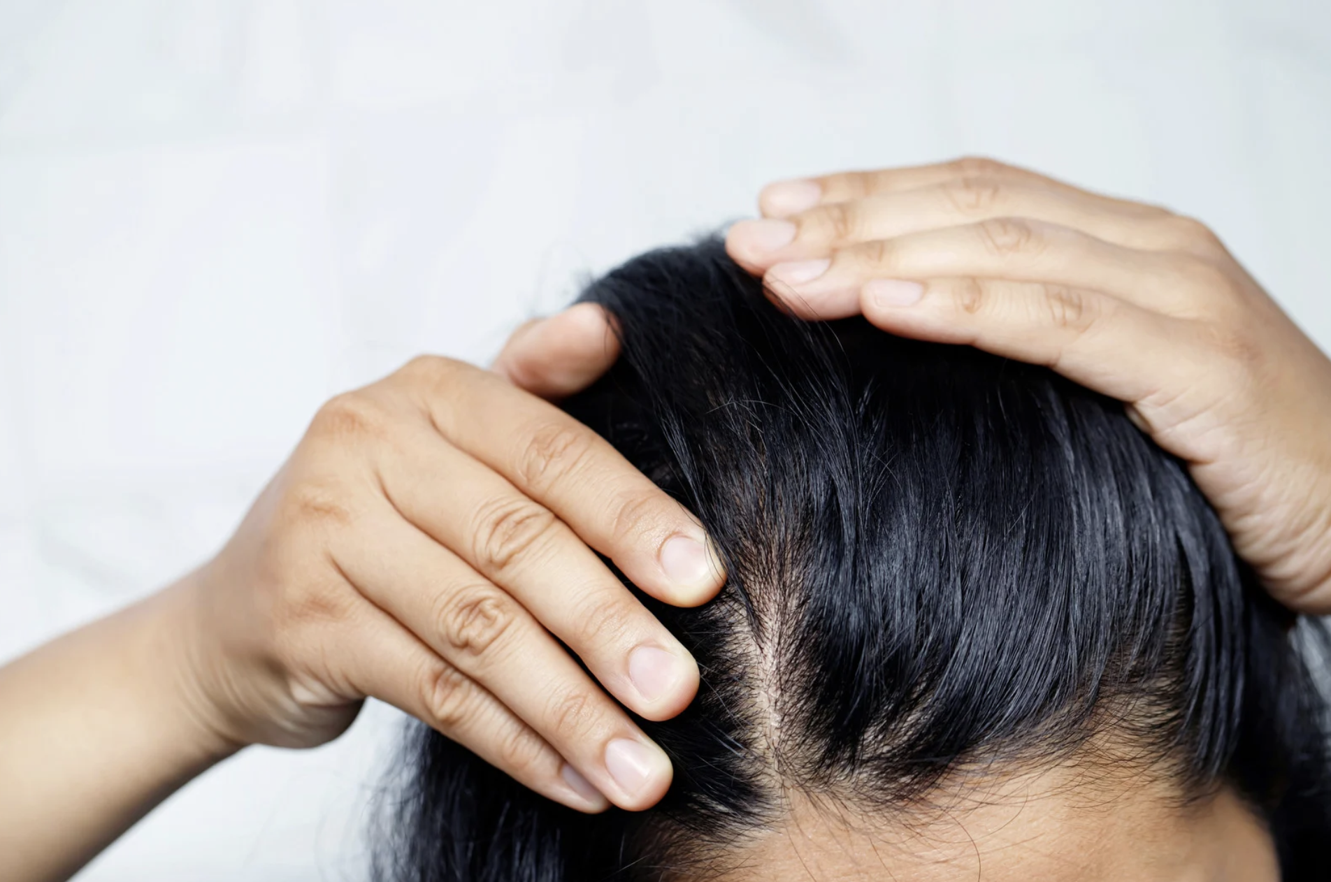Will menopausal hair loss grow back? - 23MD