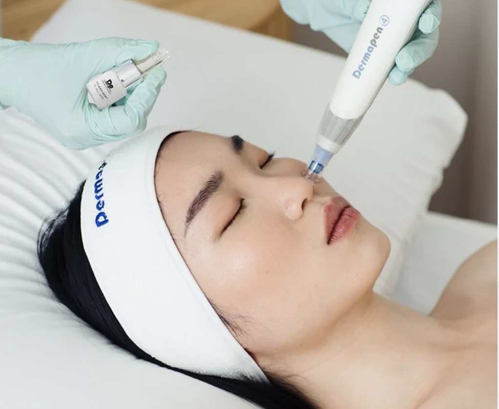 Discover Exofusion at 23MD, a transformative skincare treatment combining stem cell technology and microneedling